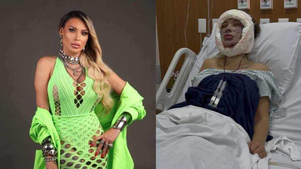 Andressa Urach chega à 50ª cirurgia plástica e impressiona com novo procedimento