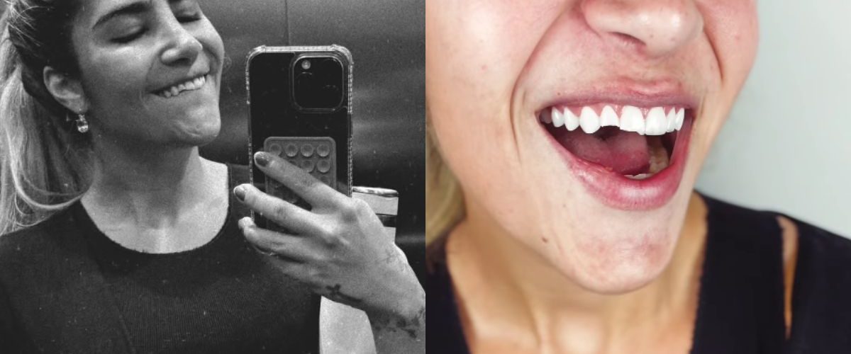 Jéssica Beatriz revela perrengue após acidente doméstico e comemora recuperação do sorriso