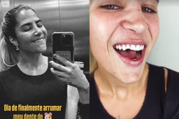 Jéssica Beatriz revela perrengue após acidente doméstico e comemora recuperação do sorriso