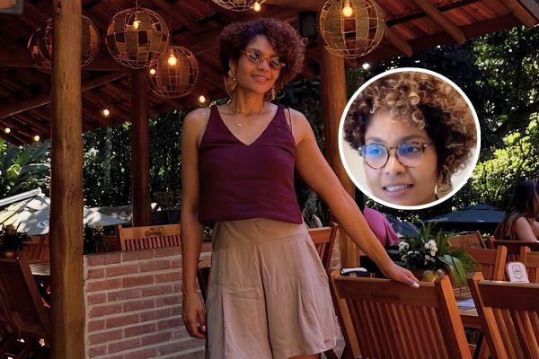 Barbara Reis comemora avanço na recuperação após cirurgia de lipedema e celebra nova fase
