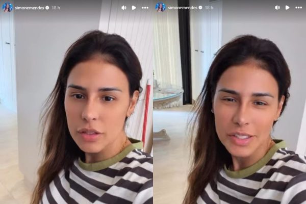 Simone Mendes surge sem curativos e revela como ficou o nariz após procedimento