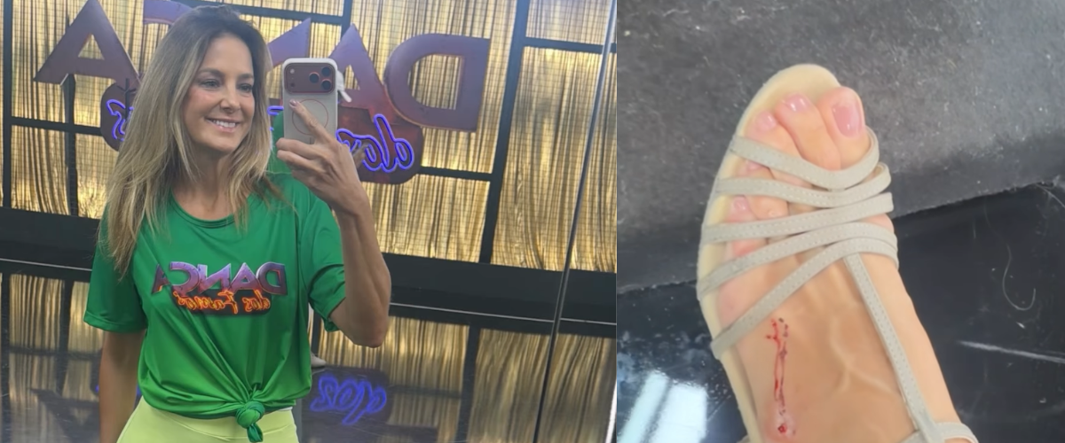 Ticiane Pinheiro exibe machucados após maratona de ensaios do Dança dos Famosos