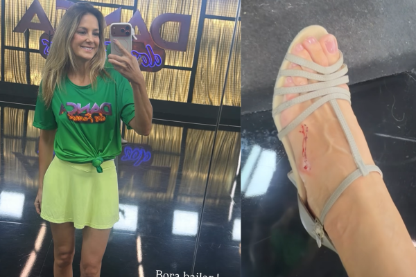 Ticiane Pinheiro exibe machucados após maratona de ensaios do Dança dos Famosos