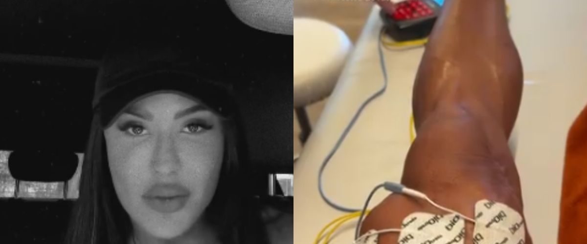 Gracyanne Barbosa comemora duas semanas sem inchaço no joelho após cirurgia