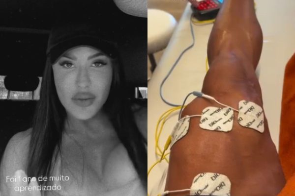 Gracyanne Barbosa comemora duas semanas sem inchaço no joelho após cirurgia
